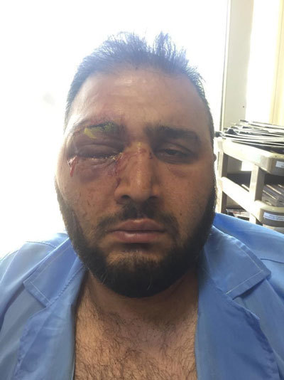 شرمِ فوتبال؛ چشم هوادار پرسپولیس تخلیه شد شرمِ فوتبال؛ چشم هوادار پرسپولیس تخلیه شد